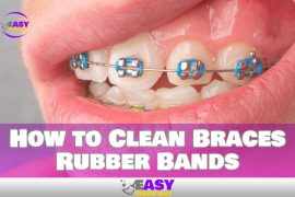 How to Clean Braces Rubber Bands – Easy Way to Clean